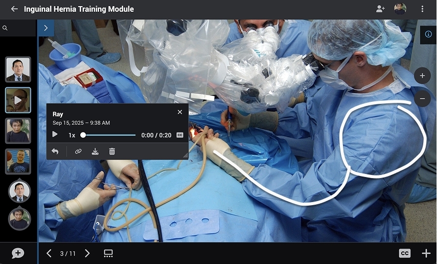 Image of a VoiceThread showing a conversation about an inguinal hernia surgical procedure